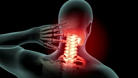 Medical 3d animation of lower back spine pain of human male having acute pain in 库存影片 336580306