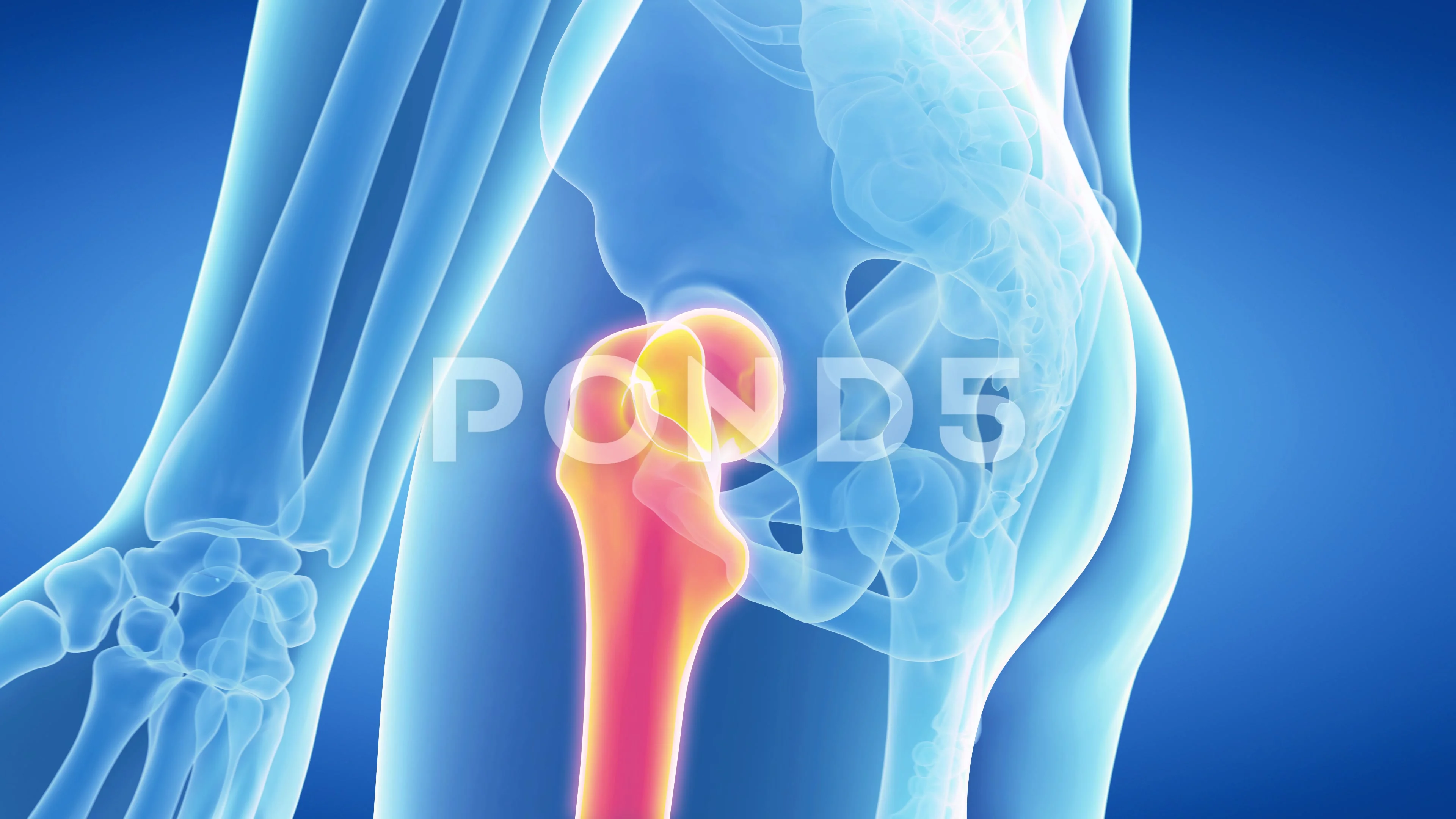 medical 3d animation of the painful huma... | Stock Video | Pond5