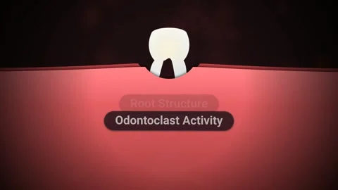 Medical Animation Of Primary Tooth Replacement Process Stock Footage 340519177