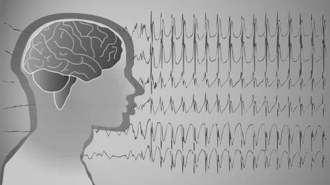 Medical background brain epilepsy Stock Illustration