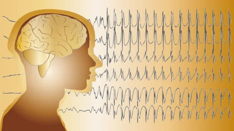 Medical background brain epilepsy Stock Illustration