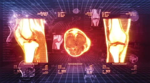 Medical Background. Loopable. Locked. Red. Stock-Footage 45198798