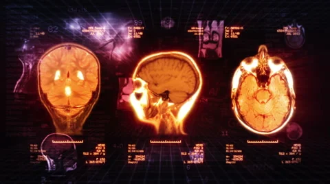 Medical Background. Loopable. Locked. Red/black. 스톡 동영상 46718713