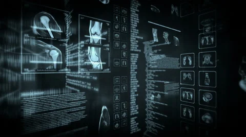 Medical background with a MRI interface. Black. Loopable. Lateral view. Stock Footage