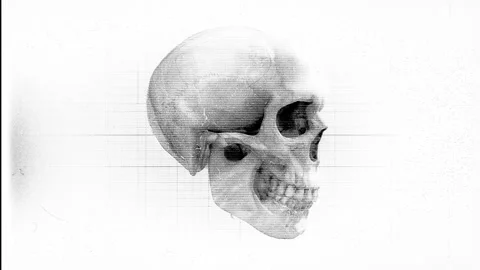 Medical Chart Skull Stock Footage 241042610