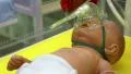 Medical complex for phototherapy, heating and neonatal resuscitation HD Footage
