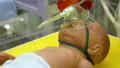 Medical complex for phototherapy, heating and neonatal resuscitation HD Footage