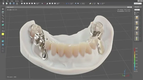 Medical Computer Interface Designing Dental Treatments For Patients Teeth Stock Footage 252487276