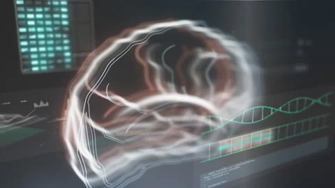 Medical computer screen with tomography of human brain. Diagnosis, Stock Footage 156448654