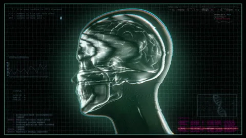 Medical Data Screen 02 Stock Footage 241042469