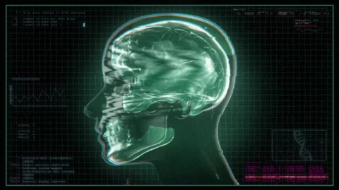 Medical Data Screen 04 Stock-Footage 241042512