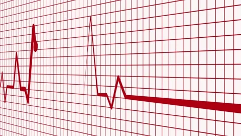 Medical Diagnostics Animation Featuring Heartbeat Waveform Signal Stock-Footage 337064904