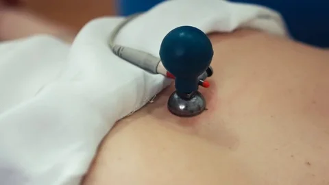 Medical diagnostics Stock Footage 73264626