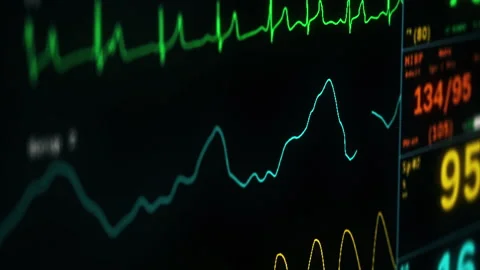 Medical Display device indicates the consistent pulse coming from the patient Stock Footage 312020424