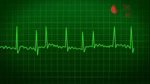 Medical display in loop - heart beat concept Vídeo Stock 165992022