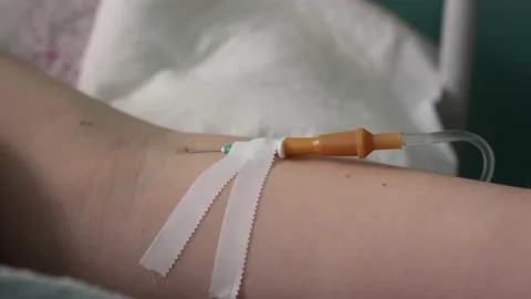 Medical dropper and needle inserted into the vein of a female arm. Stock Footage 234504722