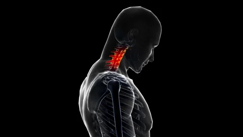 Medical dynamic video materials on bone and joint diseases Stock Footage 343202742