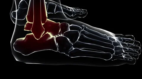 Medical dynamic video materials on bone and joint diseases Stock Footage 343203633