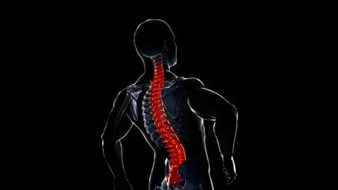 Medical dynamic video materials on bone and joint diseases-Spine Stock Footage 343724835