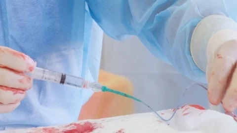 Medical endoscopy surgery. 库存影片 118261257