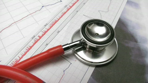 Medical equipment and records. Stethoscope and patient charts. Stock Footage