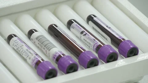 Medical equipment for testing tests. Stock Footage 139064322