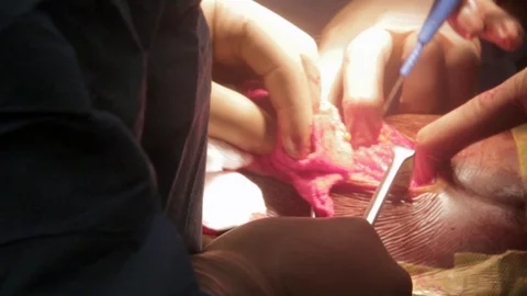 Medical Video stock 123668604