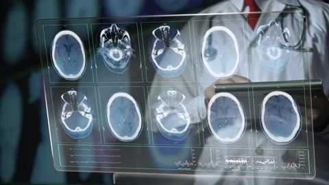 Medical Futuristic Data Stock-Footage 200162345