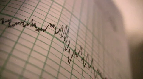 Medical Graph 库存影片 1051052