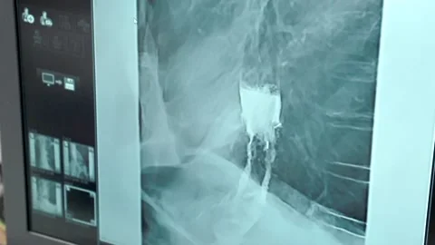 Medical image of the processes of internal organs on a computer screen Video stock 168569160