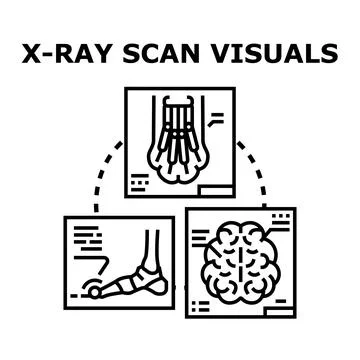 Medical imaging process with x ray body scans Stock Illustration