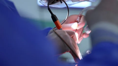 Medical instruments in the gloved hands of the surgeon. Stock Footage 309406356