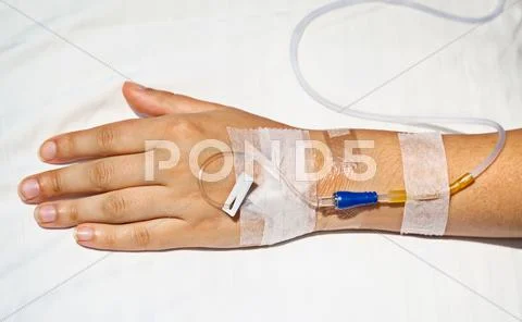 Medical intravenous cannula on hand Stock Photos