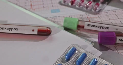 Medical investigation of monkeypox with sample vials and test results on a table Stock Footage 306989441