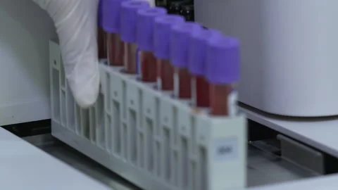 Medical Lab Imaging - Blood Testing Stock Footage 318458080