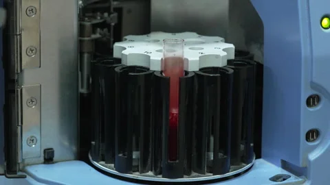 Medical Lab Imaging - Blood Testing Stock Footage 318458450