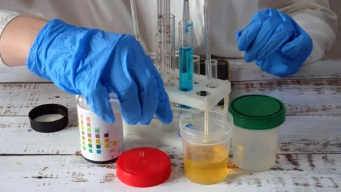 Medical laboratory assistant taking test tube with liquids, test with urine.. Stock Footage 253706202