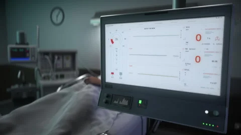 Medical Machine For Artificial Lung Ventilation Shows Decrease In Vital Signs 库存影片 259187048