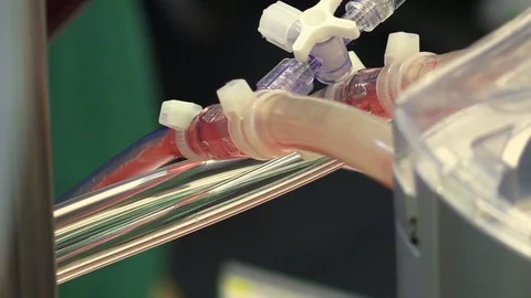 Medical machine in operation Stock Footage 85899130