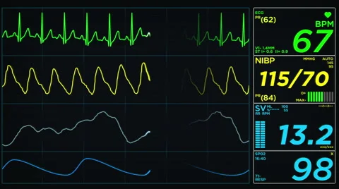 Heart Rate Stock Video Footage for Free Download
