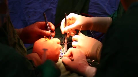Medical operation Video stock 977974