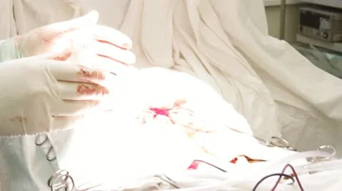 Medical operation Video stock 12553200