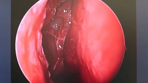 Medical Operation HD Stock Footage 72094019