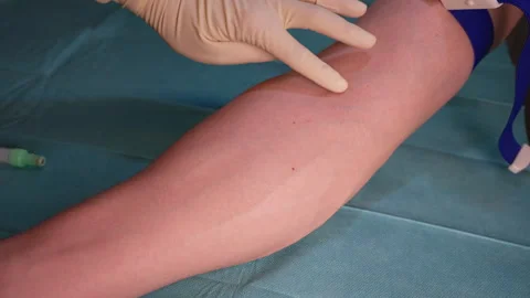 Medical Phlebotomy Preparation 動画素材 338186667