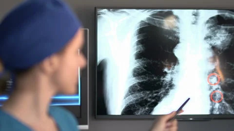  Medical Presentation Close up Stock Footage 210226424