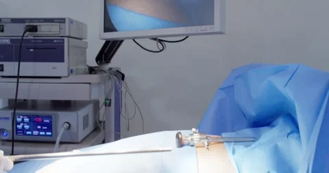 Medical Procedure Stock Footage 262895027
