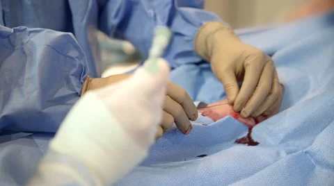 Medical Procedure on Operating Table Vidéo 62805889