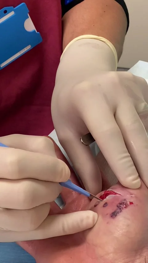 Medical Professional Explaining Procedure During Dog Bite Operation, Portsmouth, Vidéo 243589412