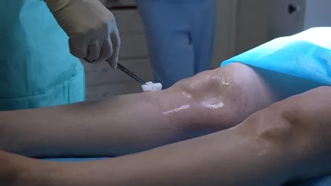 Medical professional in surgical gloves using forceps and a sterile pad to apply Stock Footage 345682088