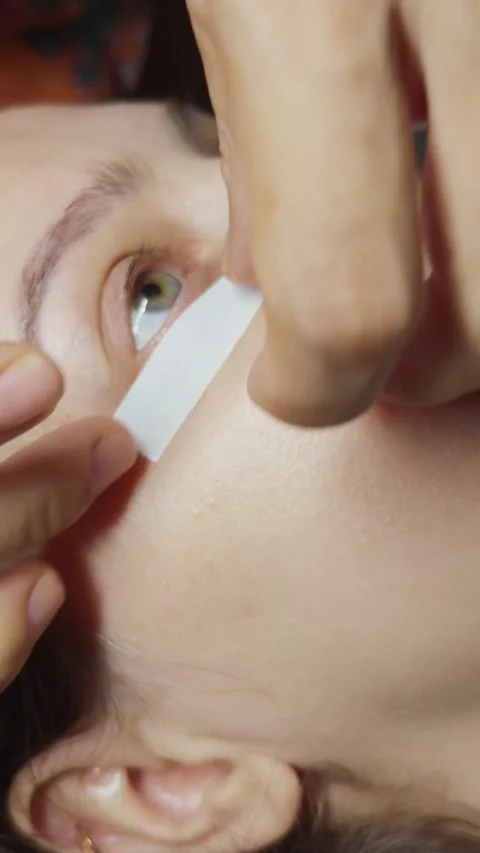 Medical professional using fingers to apply a white thread to a patient's eye Stock Footage 332794029